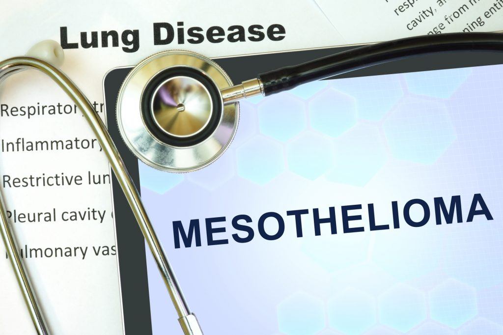 mesothelioma