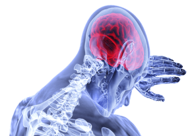 Mild Traumatic Brain Injury